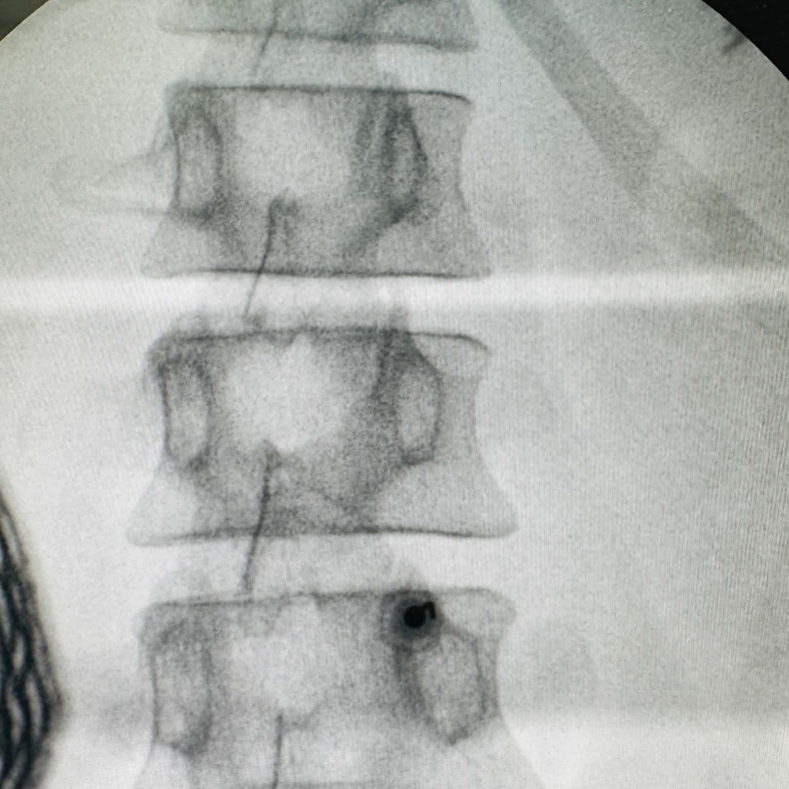 Fluoroscopy clinical image 01