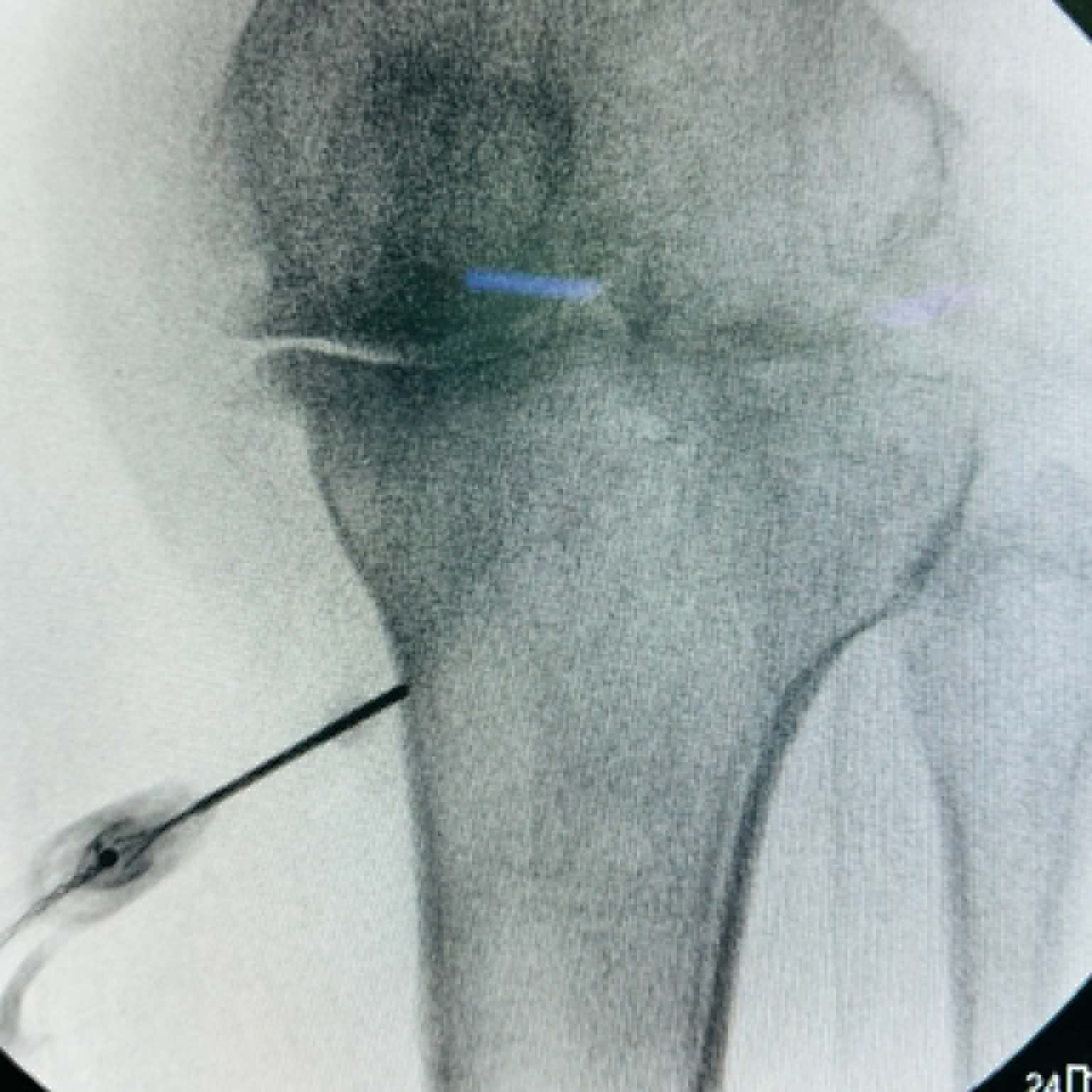 Fluoroscopy clinical image 03