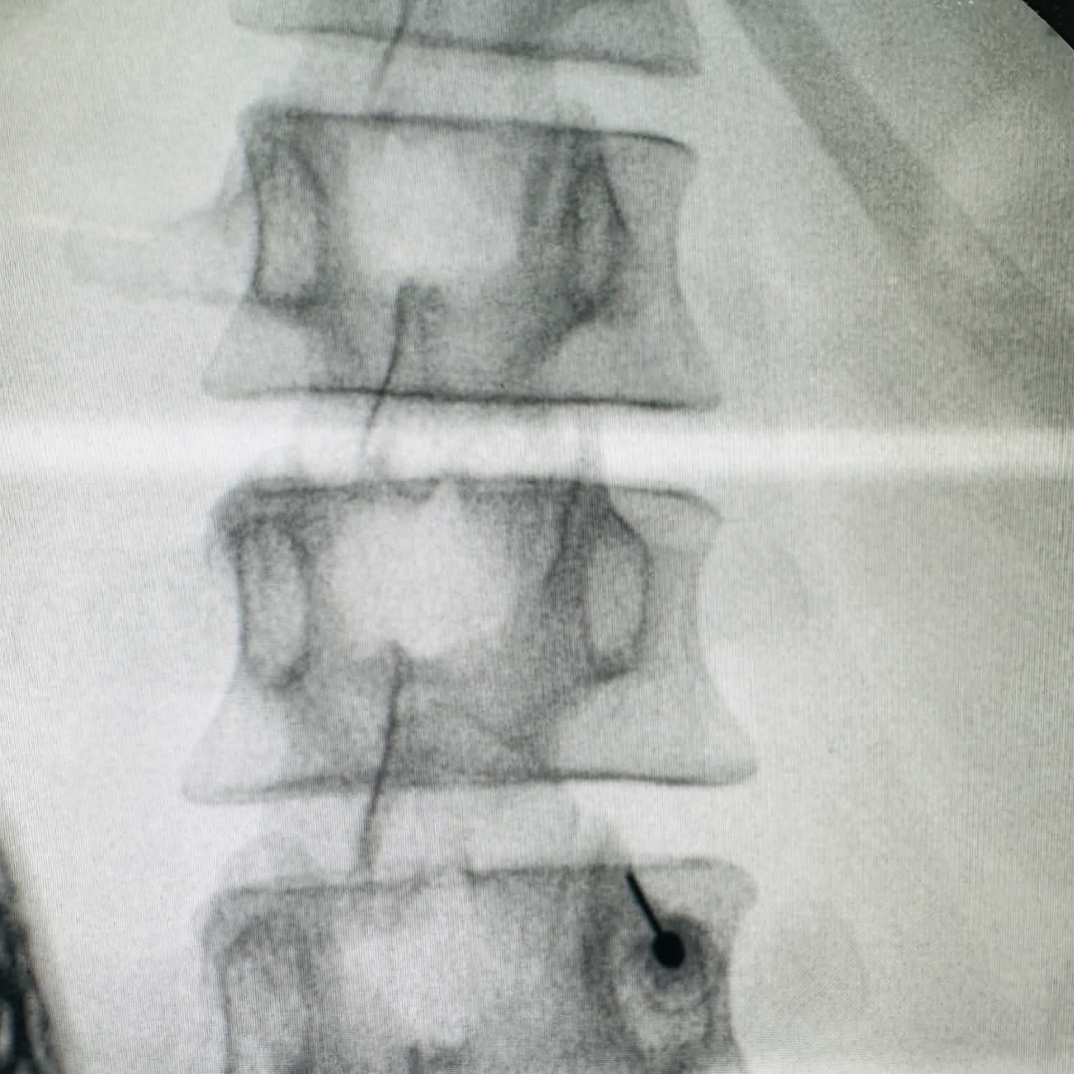 Fluoroscopy clinical image 04