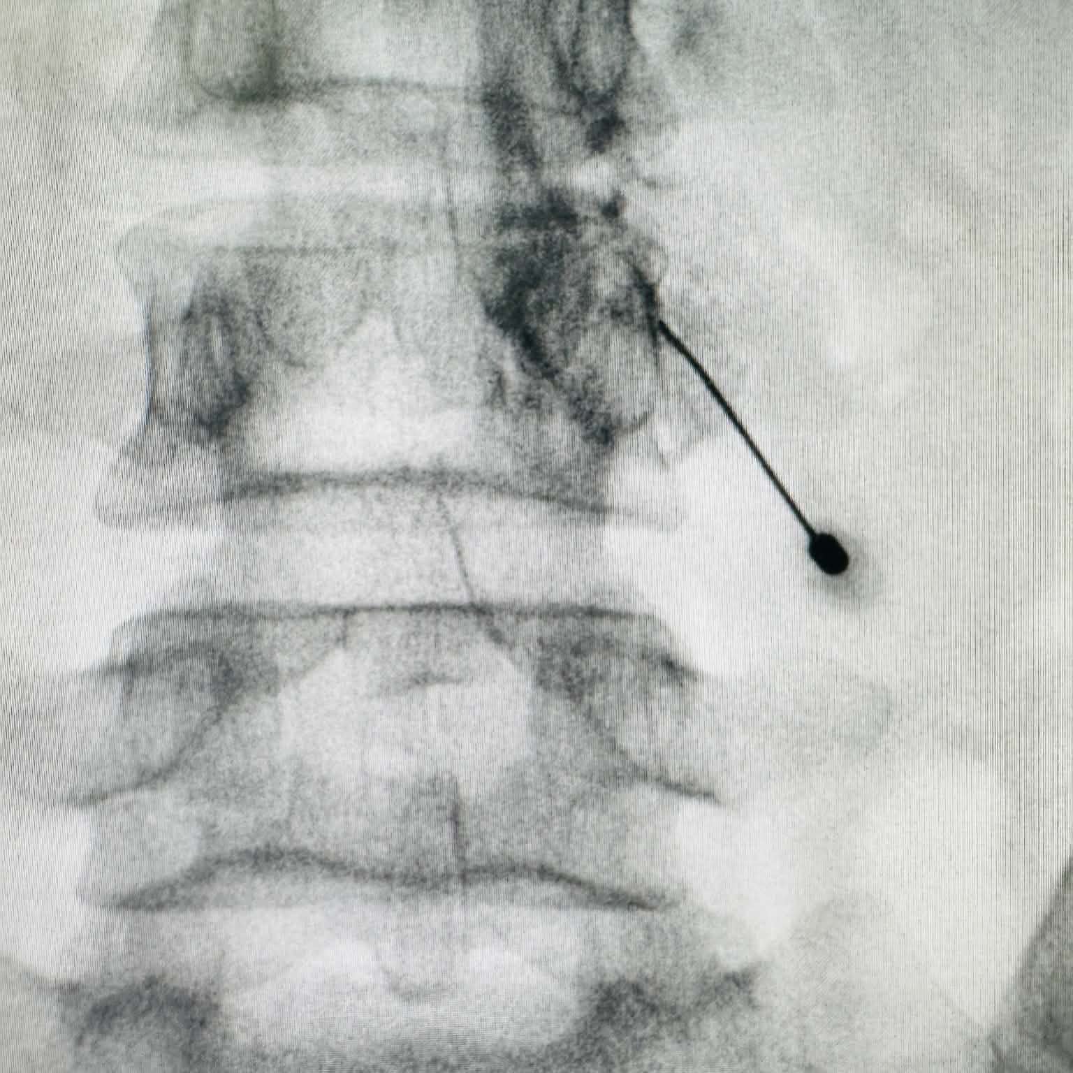Fluoroscopy clinical image 05
