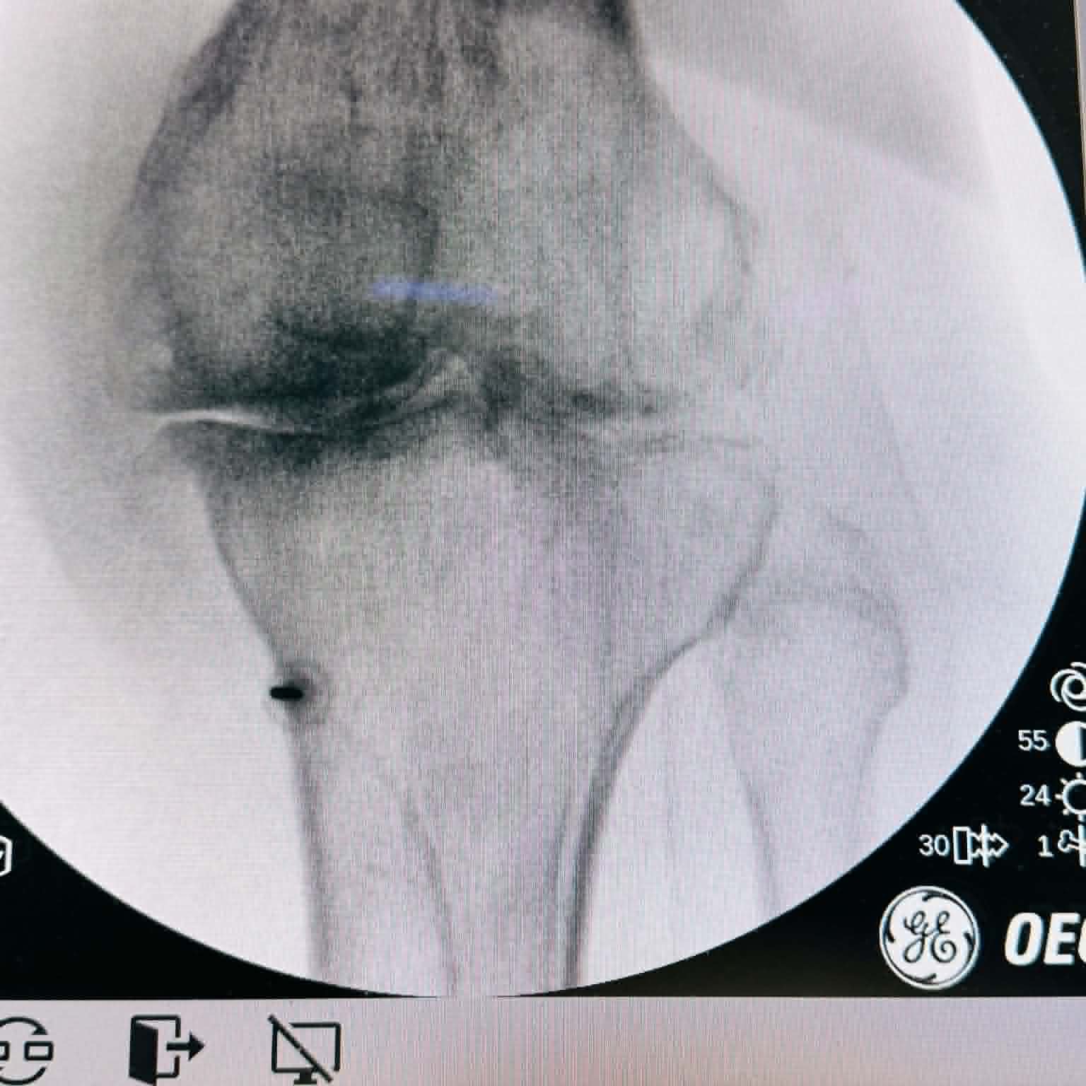 Fluoroscopy clinical image 06