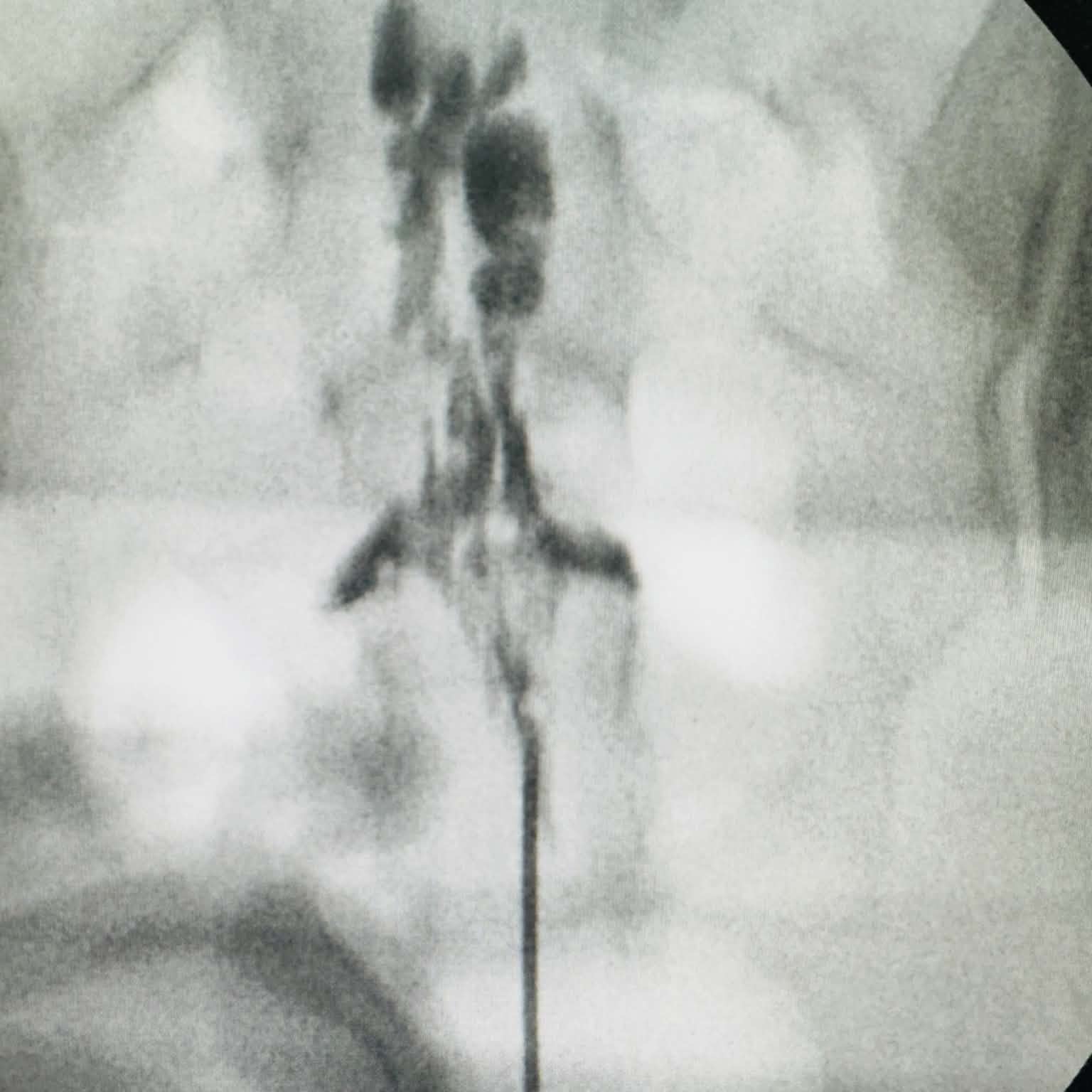 Fluoroscopy clinical image 07