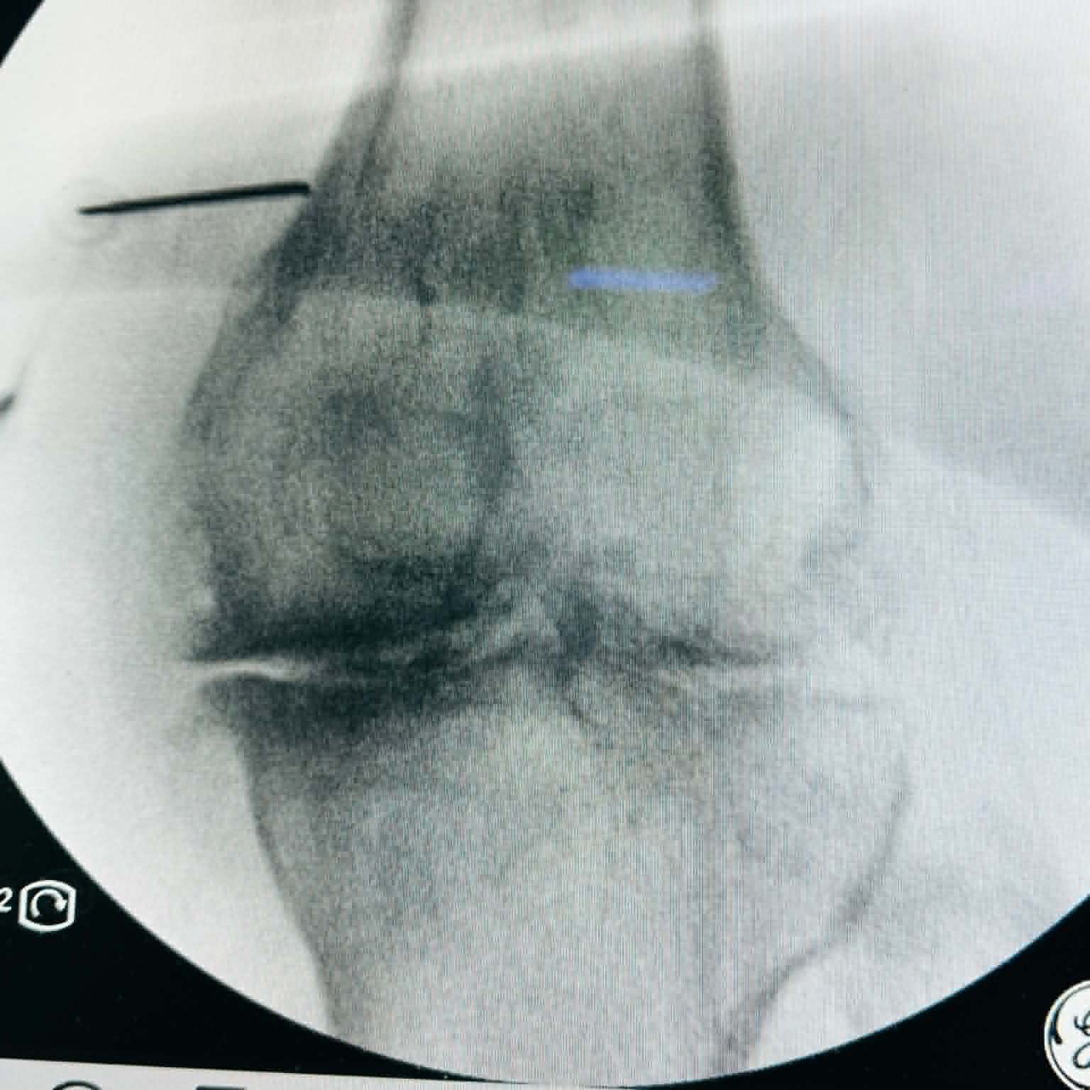 Fluoroscopy clinical image 08