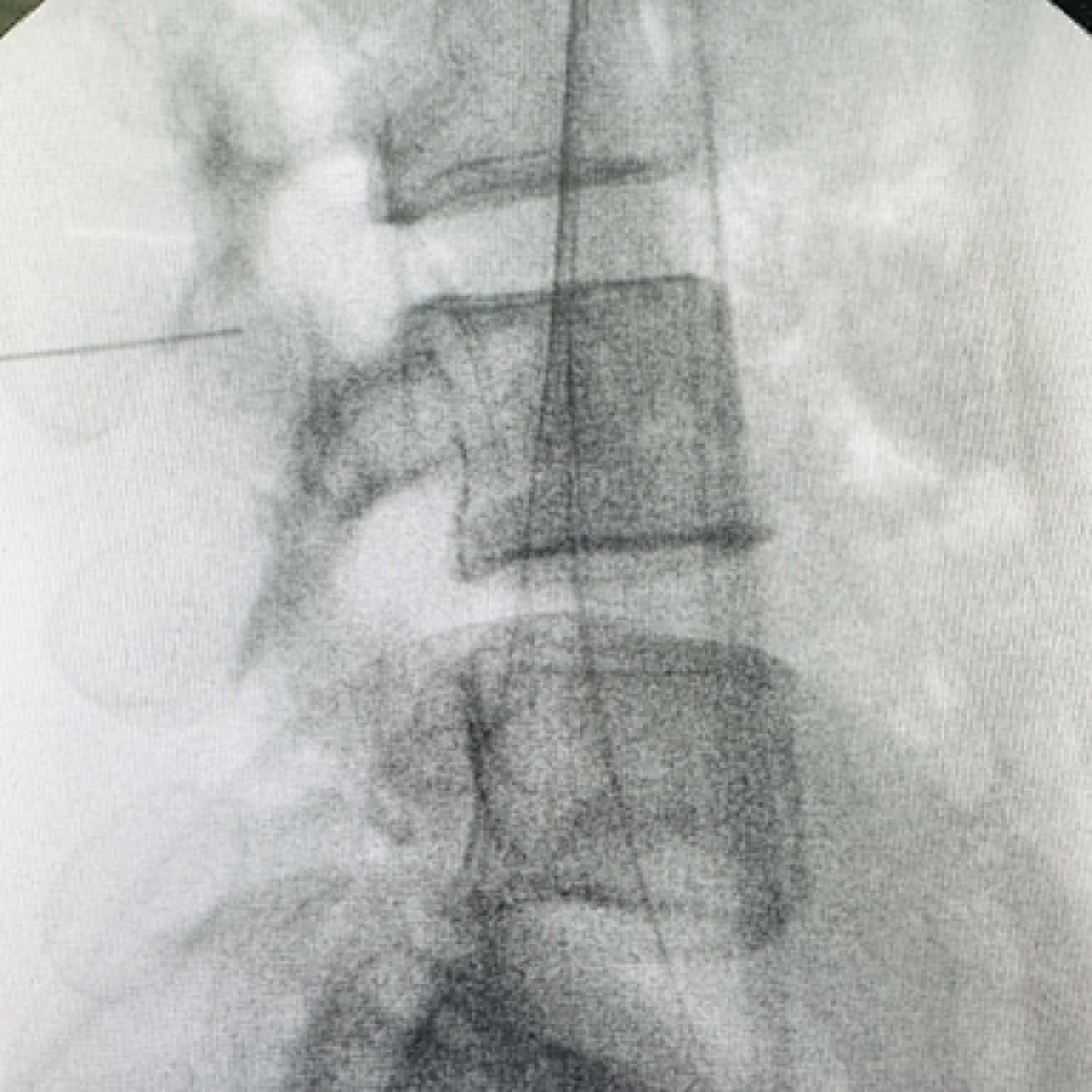 Fluoroscopy clinical image 09