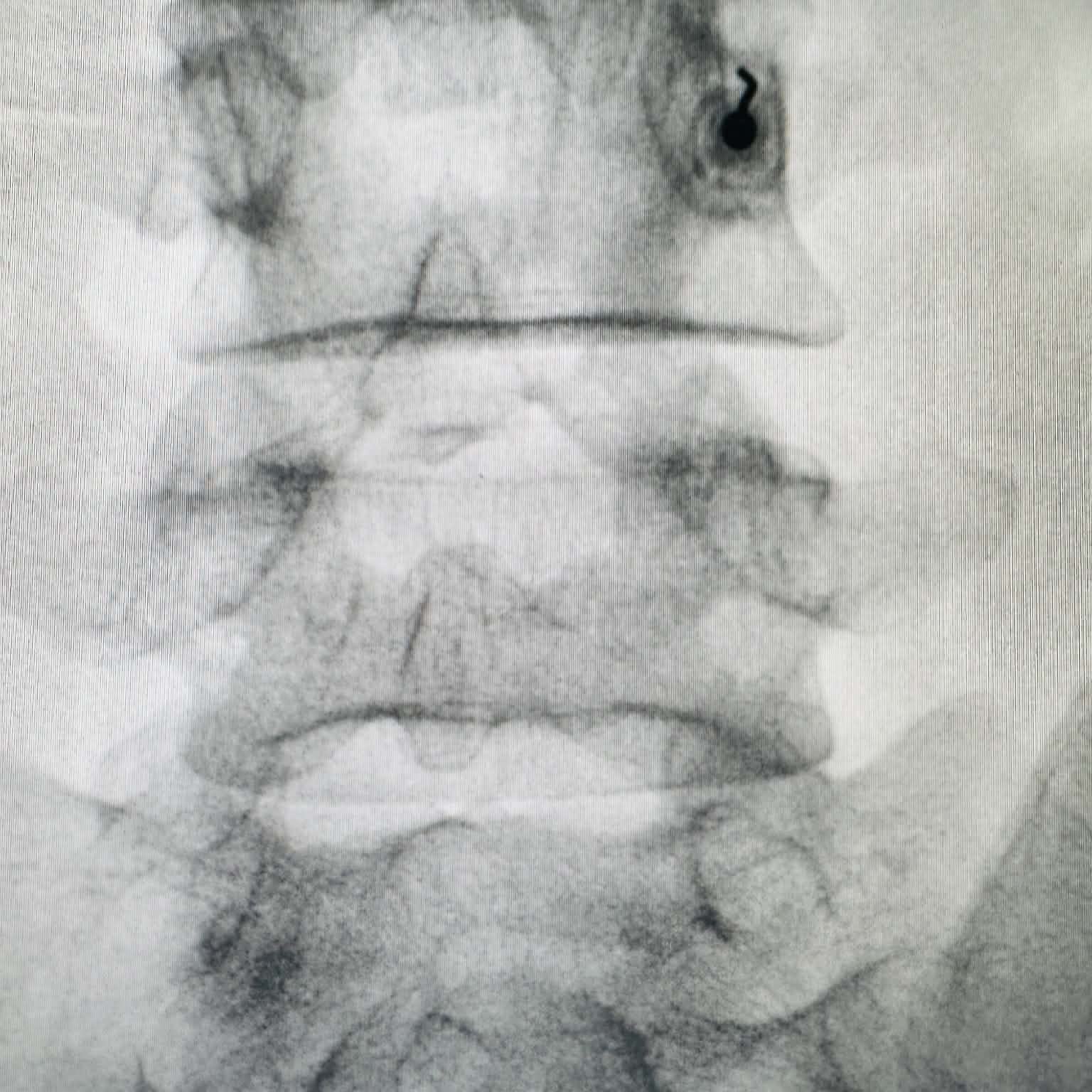 Fluoroscopy clinical image 10