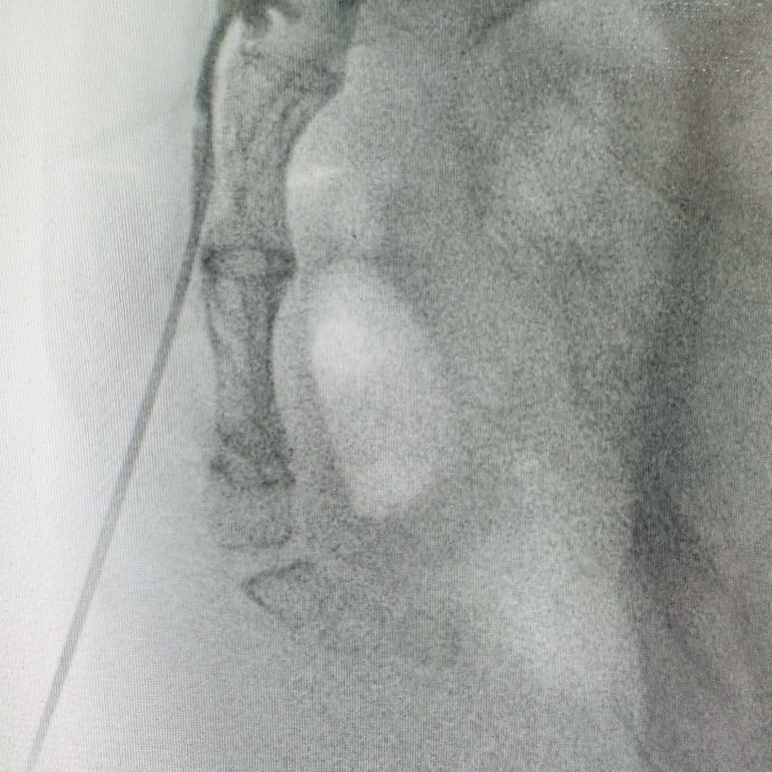 Fluoroscopy clinical image 12