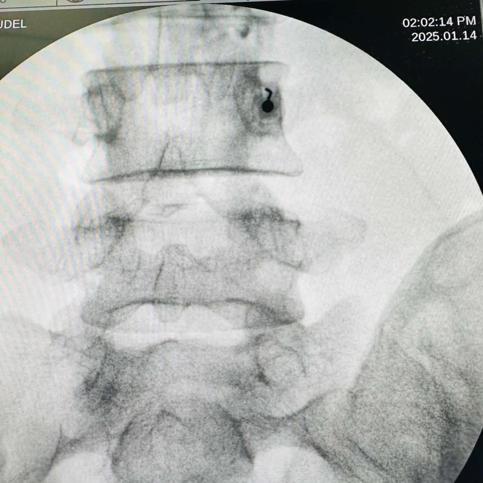 Fluoroscopy clinical image 13