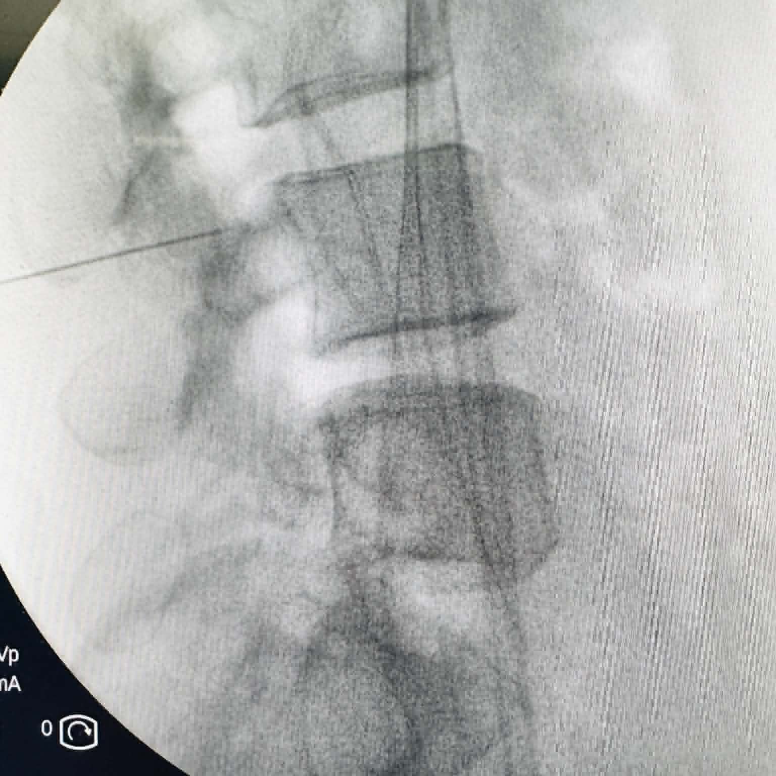 Fluoroscopy clinical image 14
