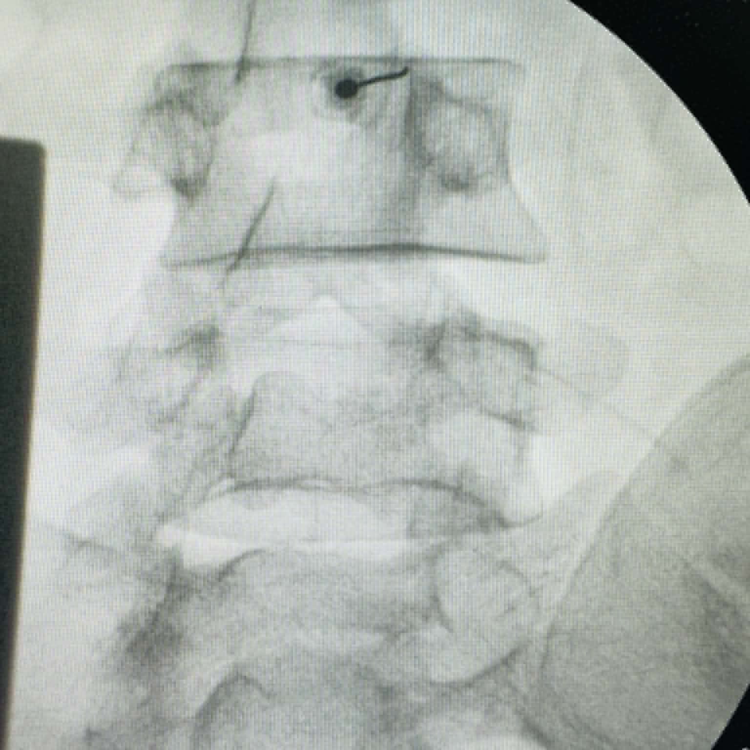 Fluoroscopy clinical image 15
