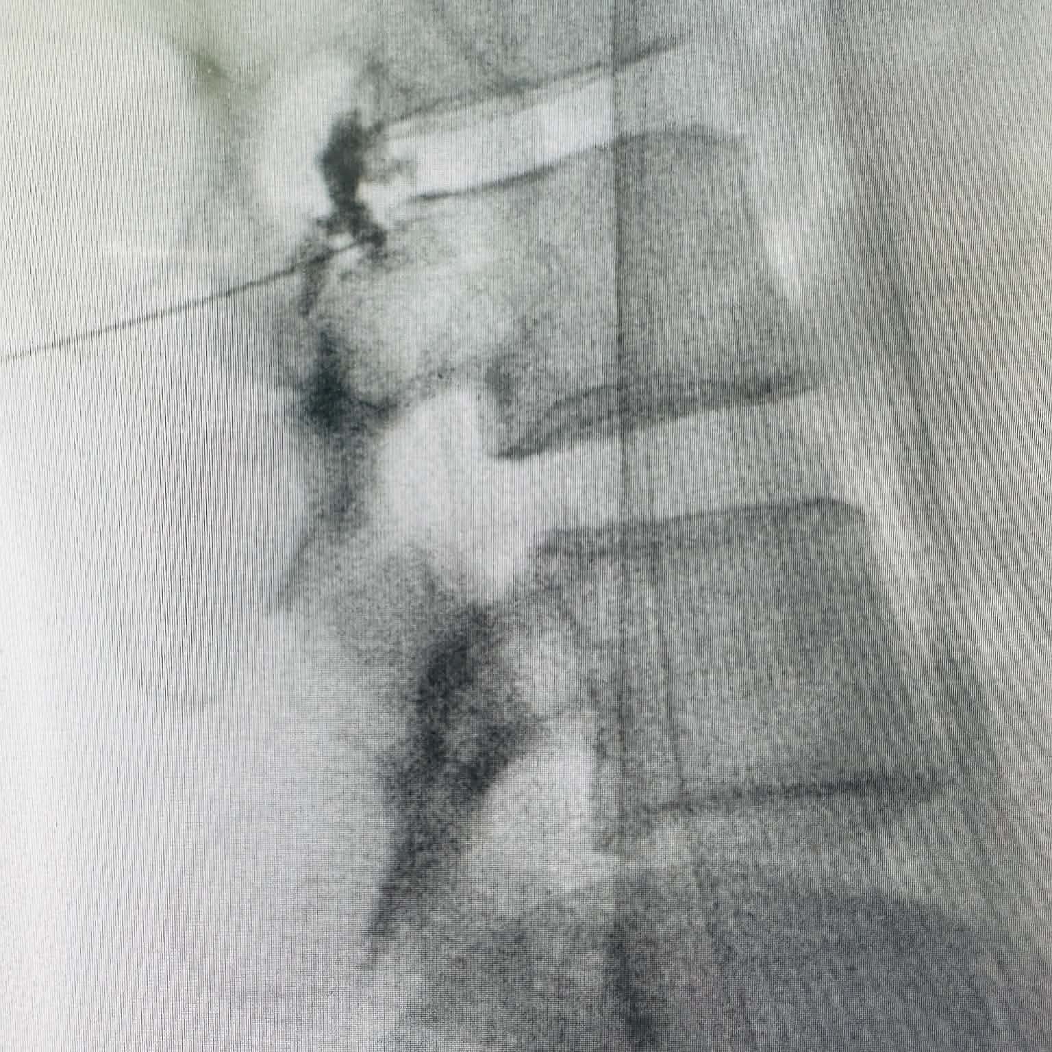 Fluoroscopy clinical image 16