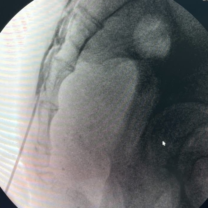 Fluoroscopy clinical image 17