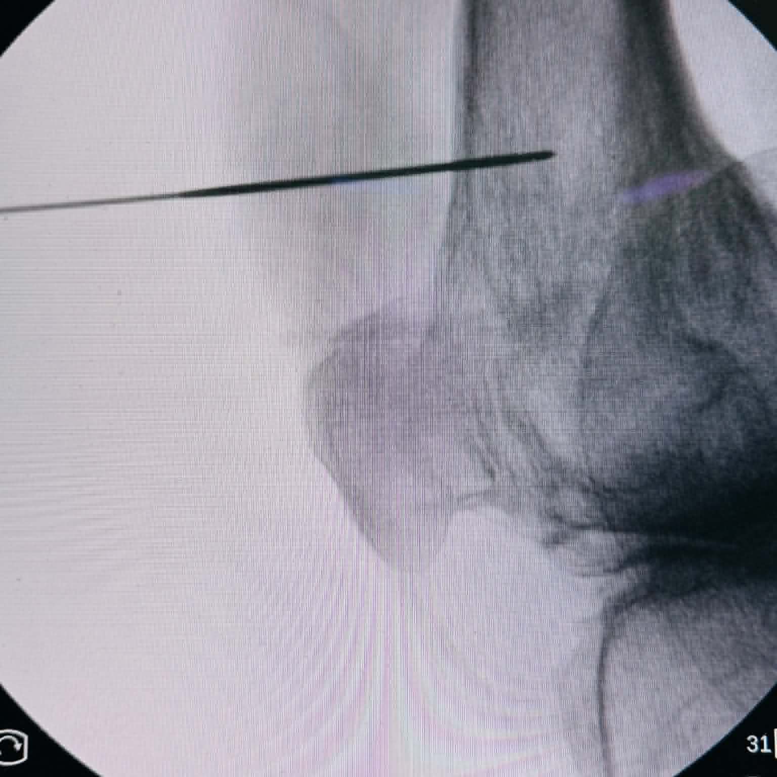 Fluoroscopy clinical image 19