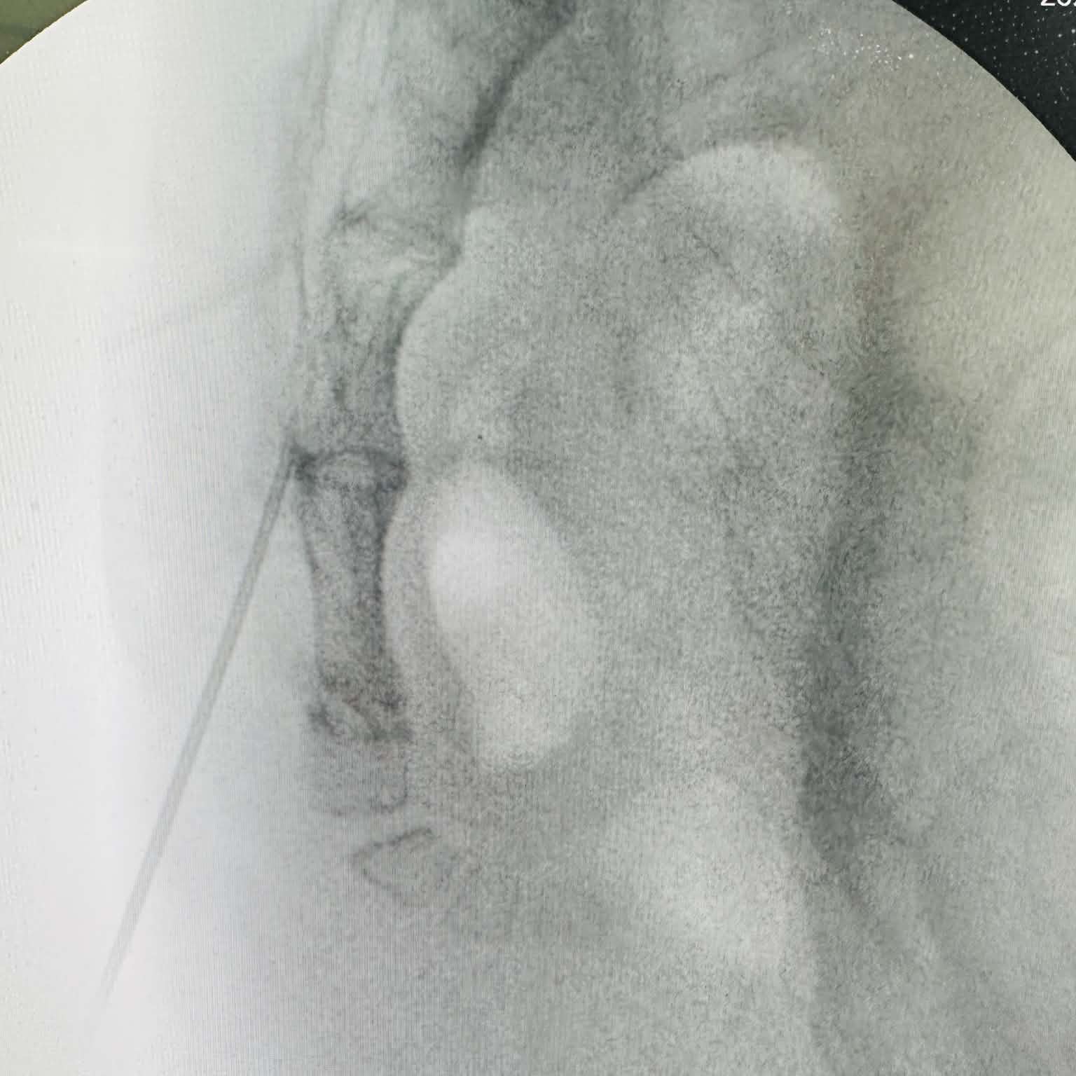 Fluoroscopy clinical image 21